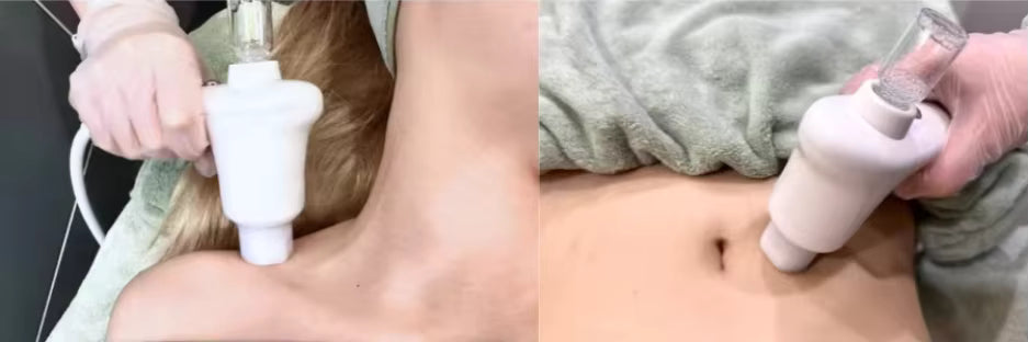 Dermoelectroporation DEP Superconducting Deepba Skin Tightening Skin Lifting Machine Facial Beauty Machine For Better Absorption