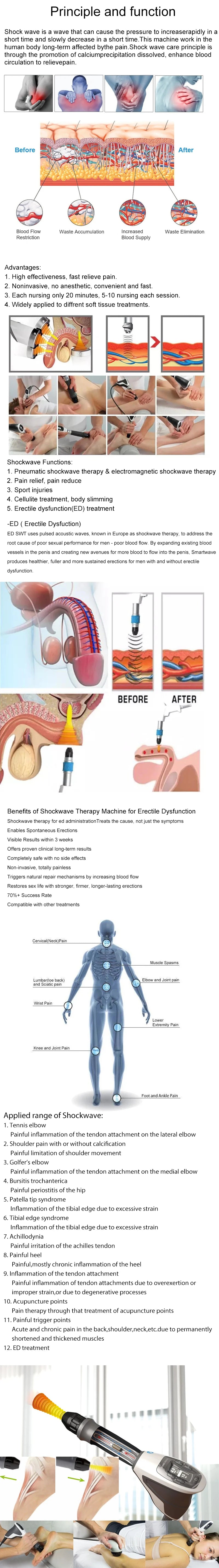 Shock Wave  Focus Shockwave Storz Focal Storz-Shockwave Radil Mb100 Ondas Shockwave Focused De Choque Body Shock Wave Machine
