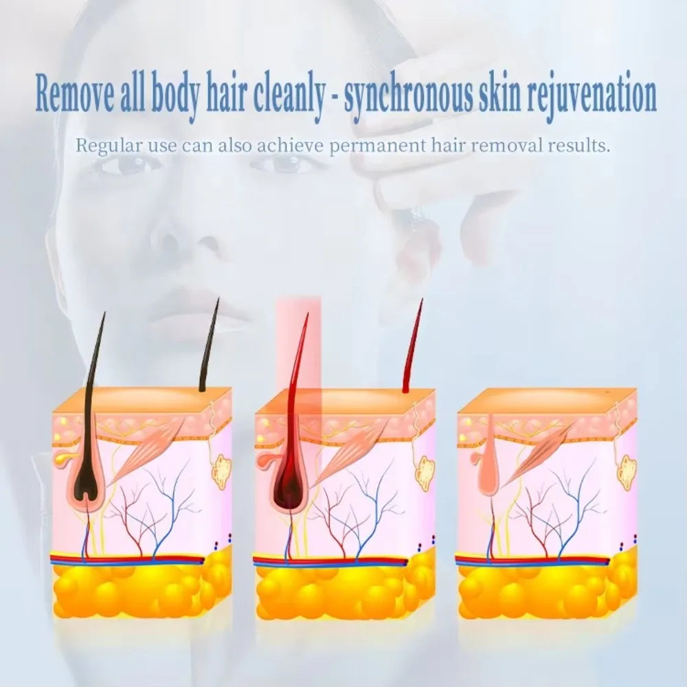 New Arrival 2025 Products High Power Laser Diode Laser Hair Removal Machine Approved Hair Removal 808 Laser Diode