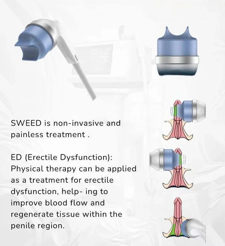 FSWT Shockwave Machine Vet Focales Focused Shock Wave Therapy Machine Plantar Fasciitis Erectile Dysfunction Treatment