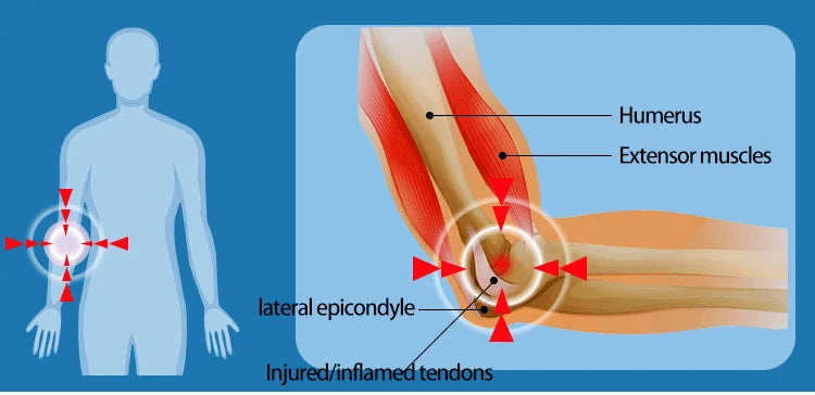 10 Bar ESWT RSWT Radial Shockwwave ESWT Therapy Release Fascia Pain And Chronic Back Pain Chiropractic  Fast Pain Relief