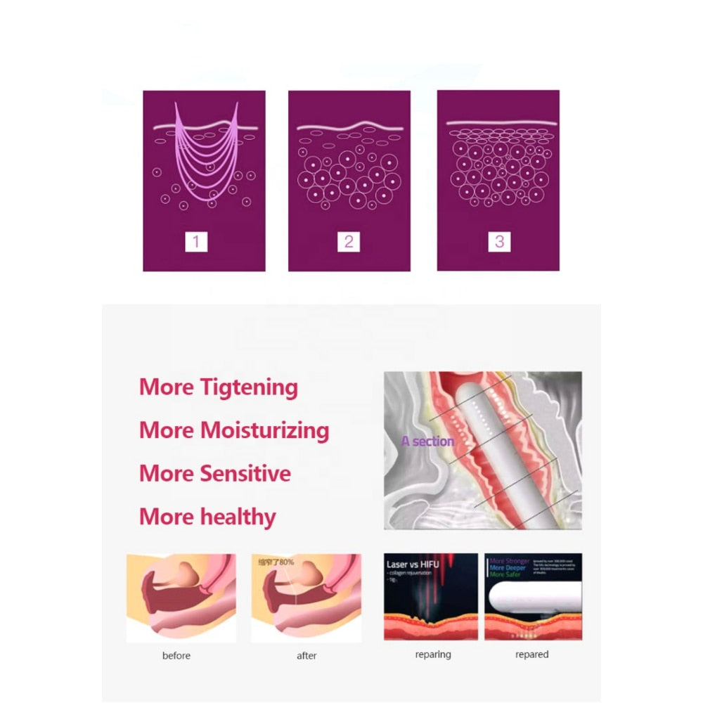 Woman Private Care Vaginal Tighten Device RF Vaginal Rejuvenation Machine 2 Handles  Fractional Rf  Beauty Health Machine